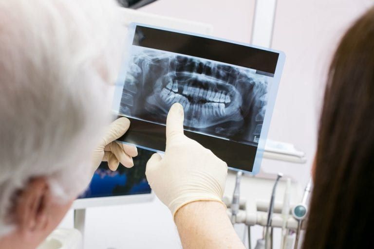 male dentist pointing at an x-ray to a patient