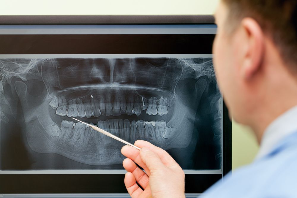 dentist pointing at x-ray of teeth
