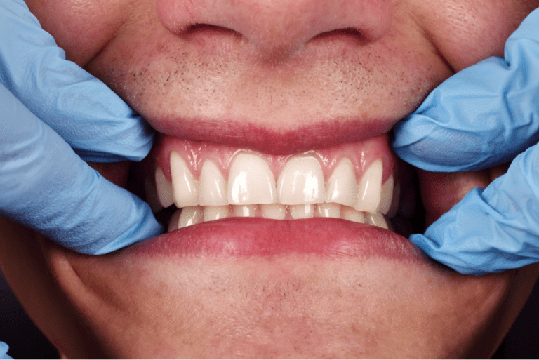 close up of human teeth