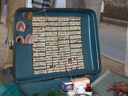 suitcase of veener and denture teeth