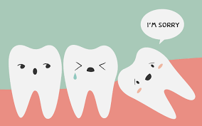 cartoon of a wisdom tooth growing in the wrong way