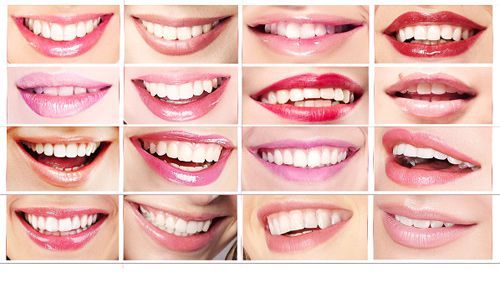 collage of different smiles