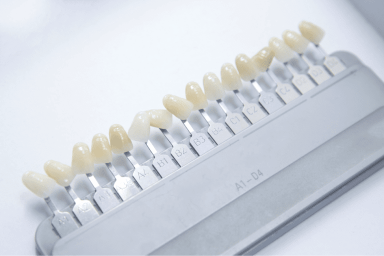 different veneer shade teeth