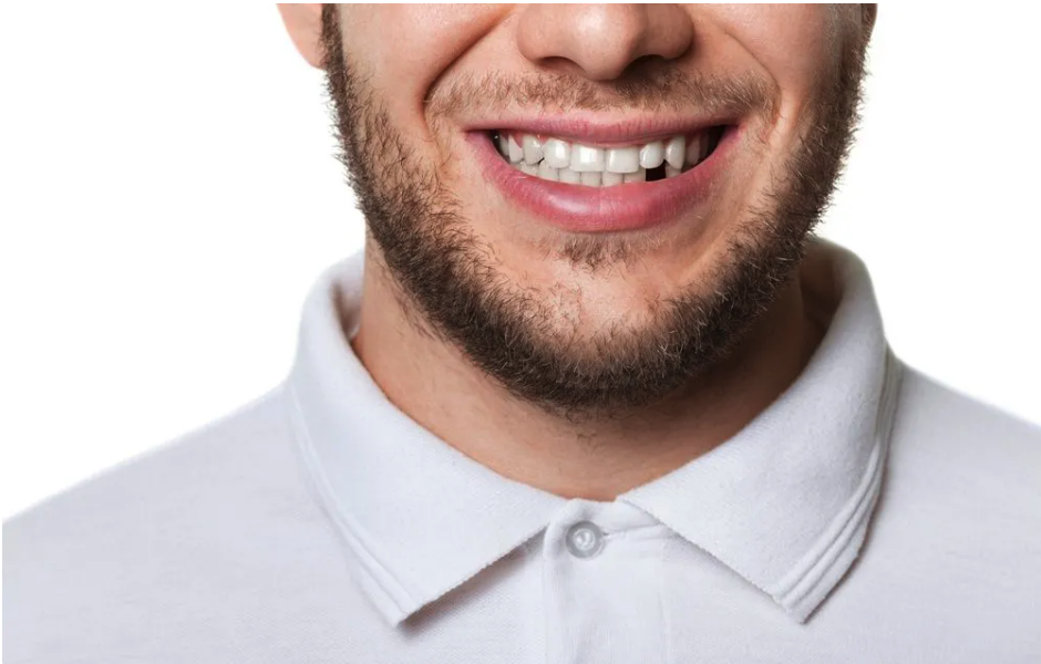 Close up of man smiling with a missing tooth