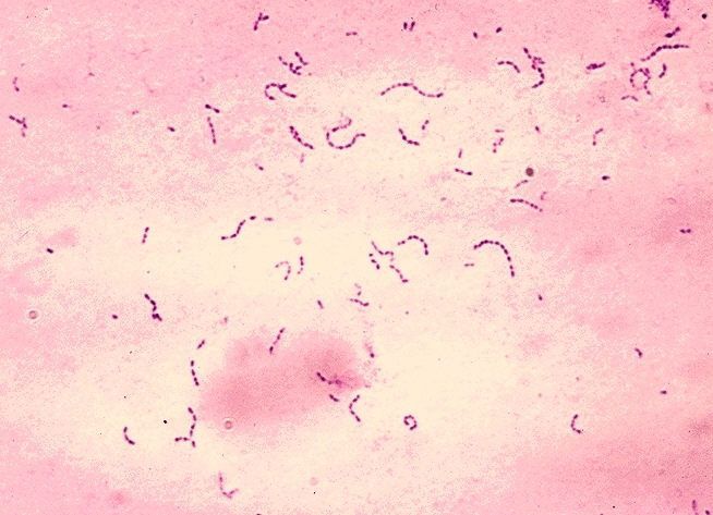 streptococcusmutans