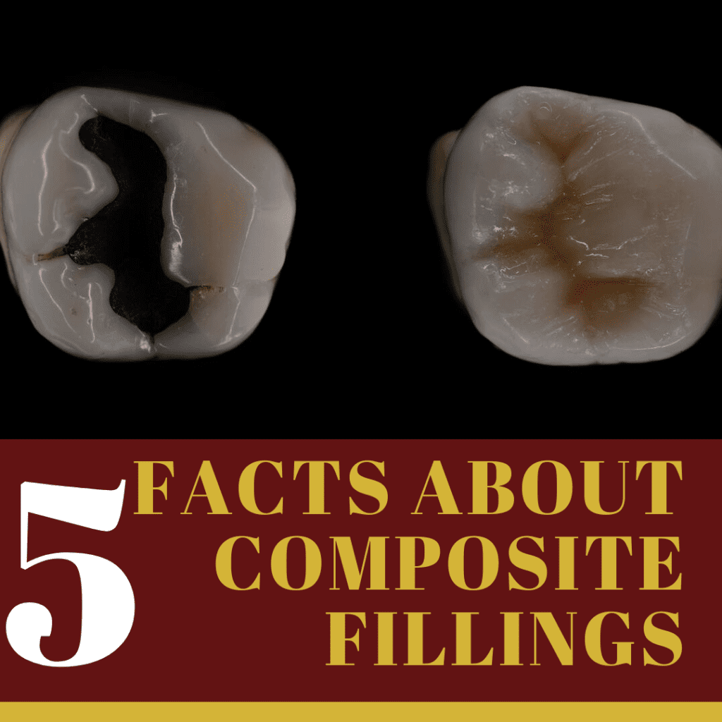 Infographic for "5 facts about composite fillings"