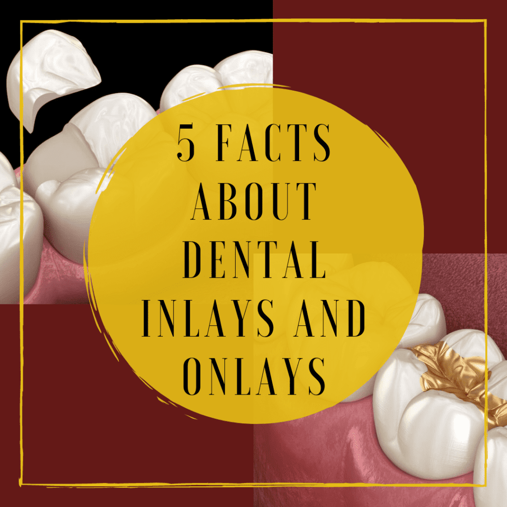 Infograph for "5 facts about dental inlays and onlays"