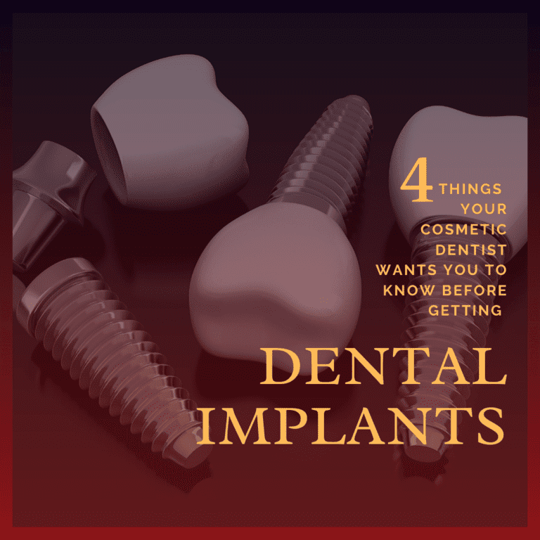 Infographic 4 Things Your Cosmetic Dentist Wants You to Know Before Getting Dental Implants