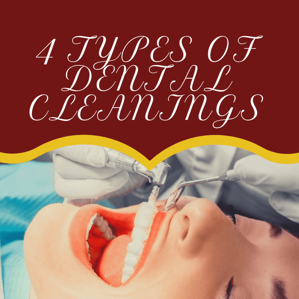 Infographic 4 Types of Dental Cleanings