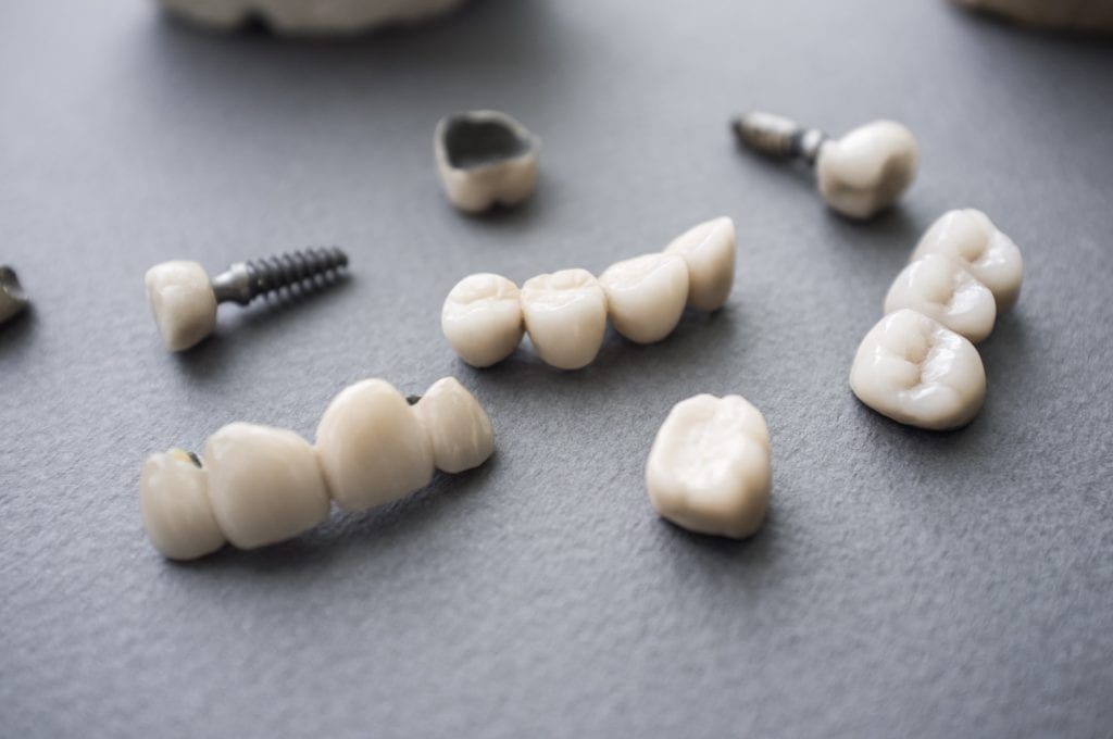 Dental implant restorations scattered on a black tabletop