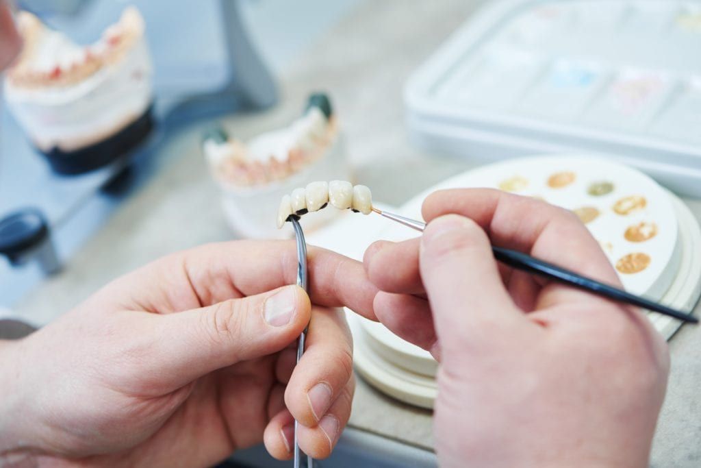 Fabricating a cosmetic denture