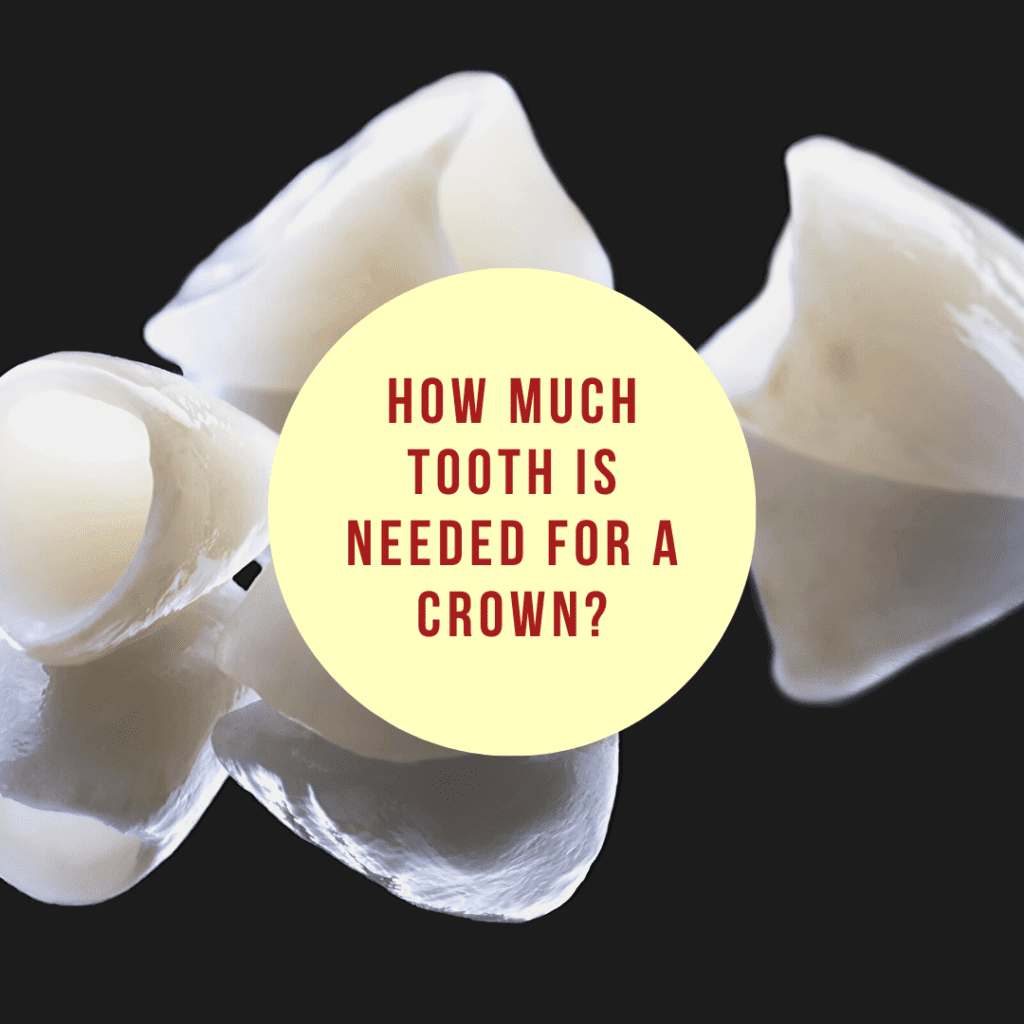 Infographic How Much Tooth is Needed for a Crown_