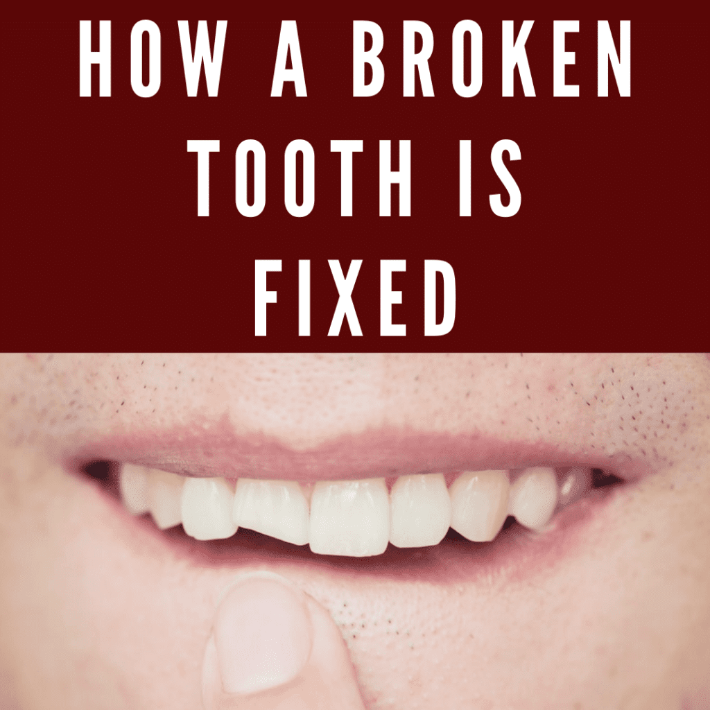 Infographic How a Broken Tooth is Fixed