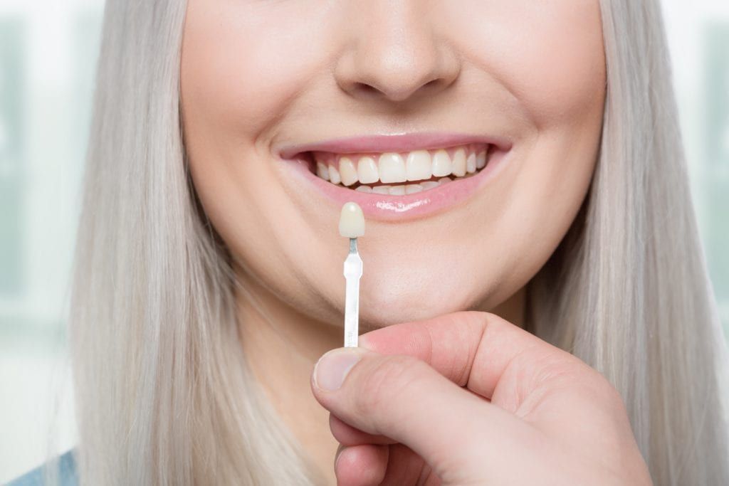 Blonde woman being matched for veneers