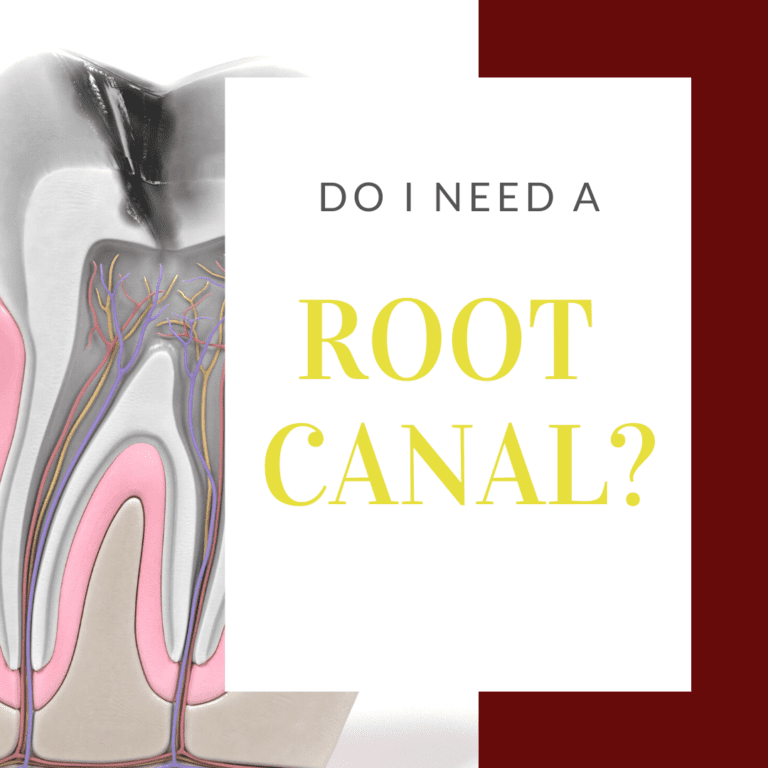 Infographic Do I Need a Root Canal