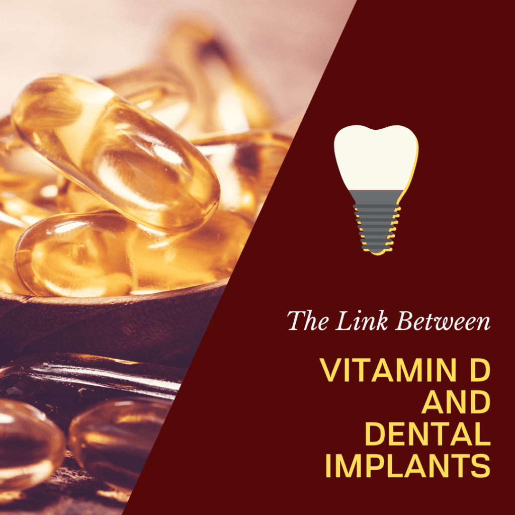 The Link Between Vitamin D and Dental Implants