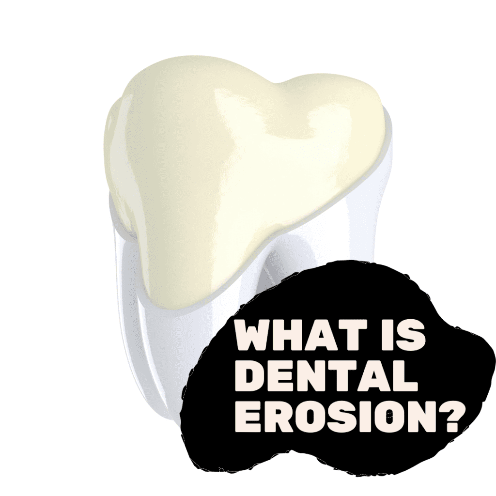 What is Dental Erosion_