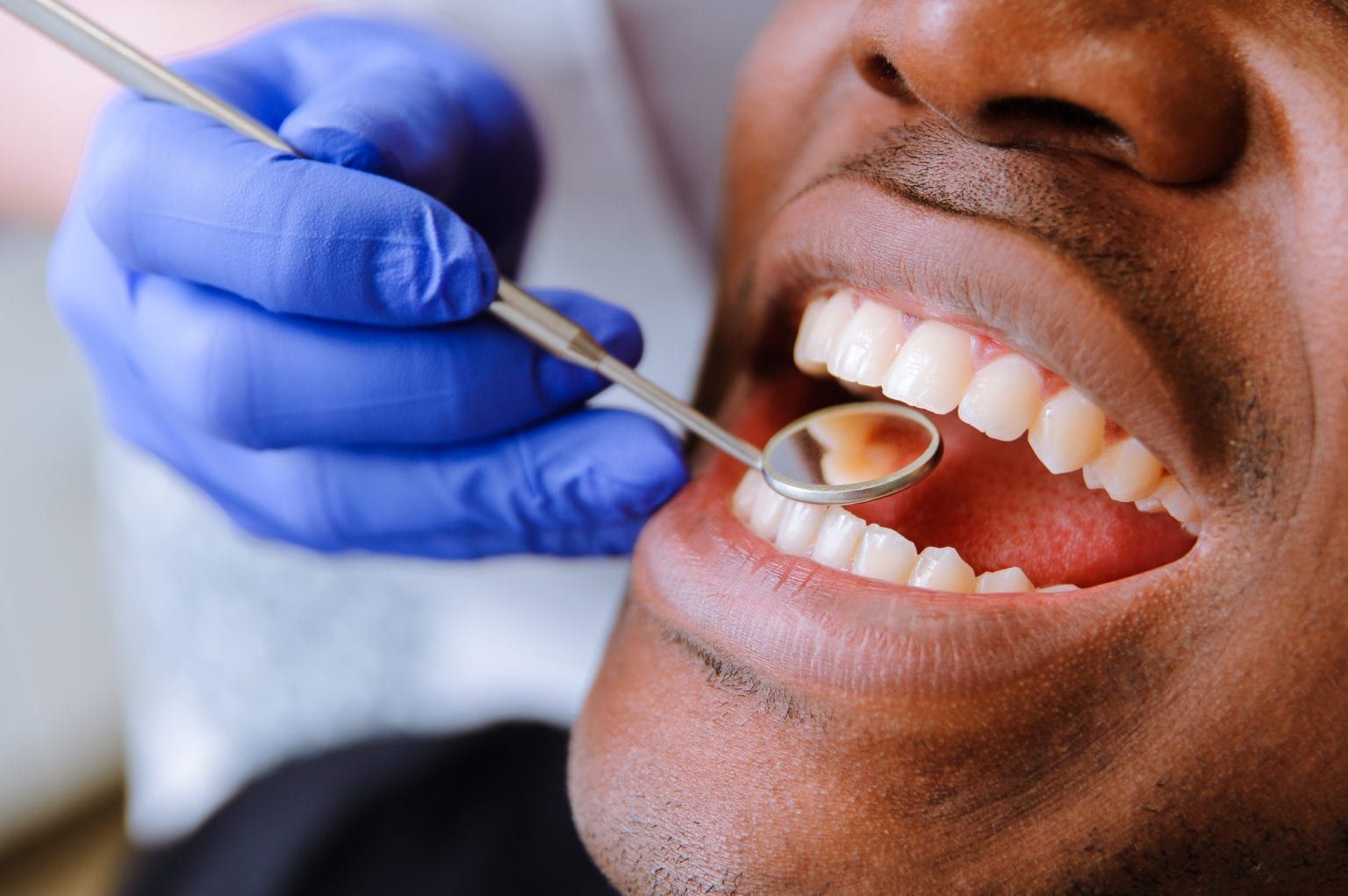 what-does-deep-teeth-cleaning-procedure-entail-blogs-webdental-llc