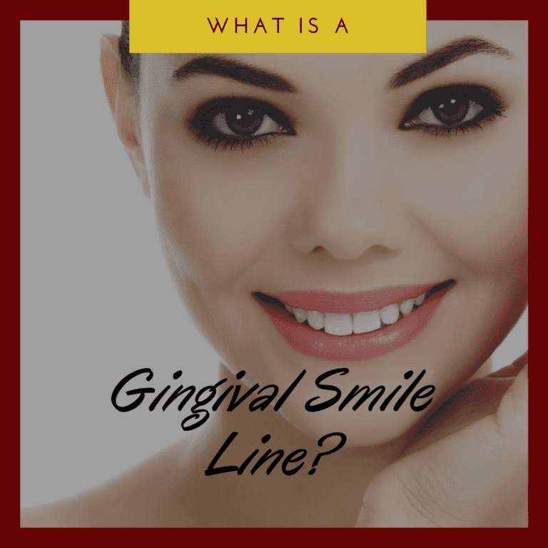What is a Gingival Smile Line
