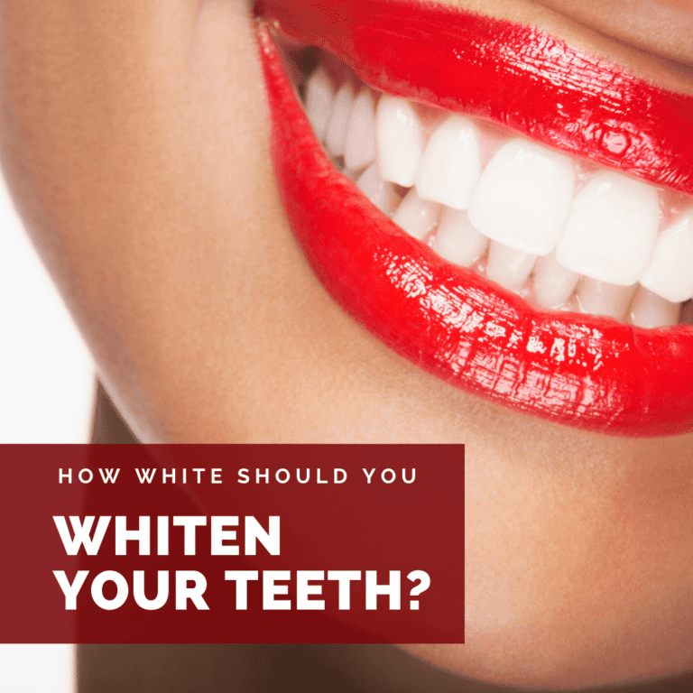 How White Should You Whiten Your Teeth_