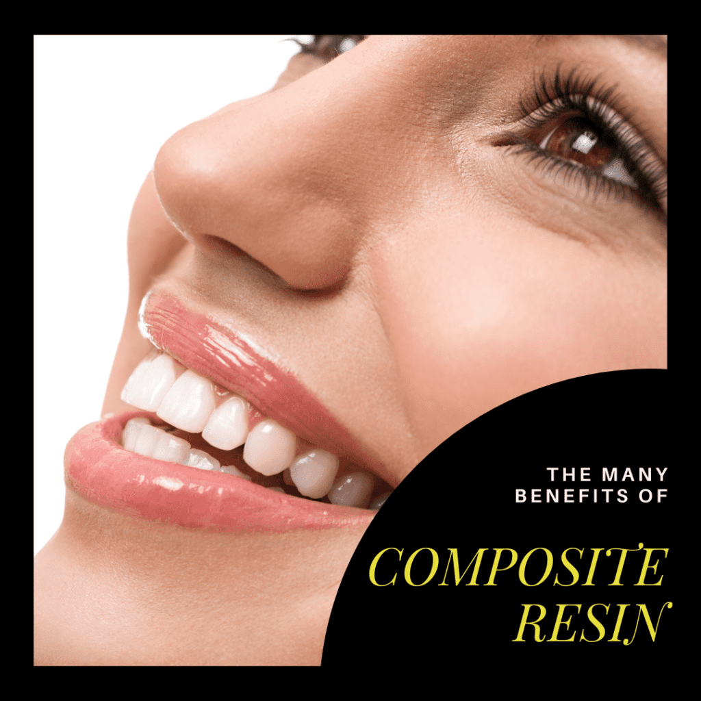 The Many Benefits of Composite Resin