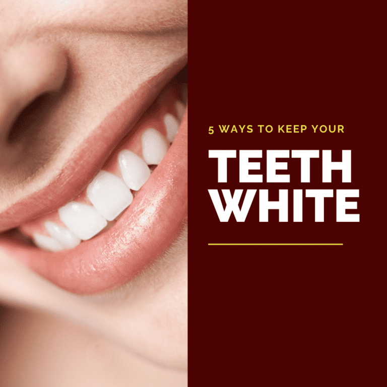 How to Keep Your Teeth White3