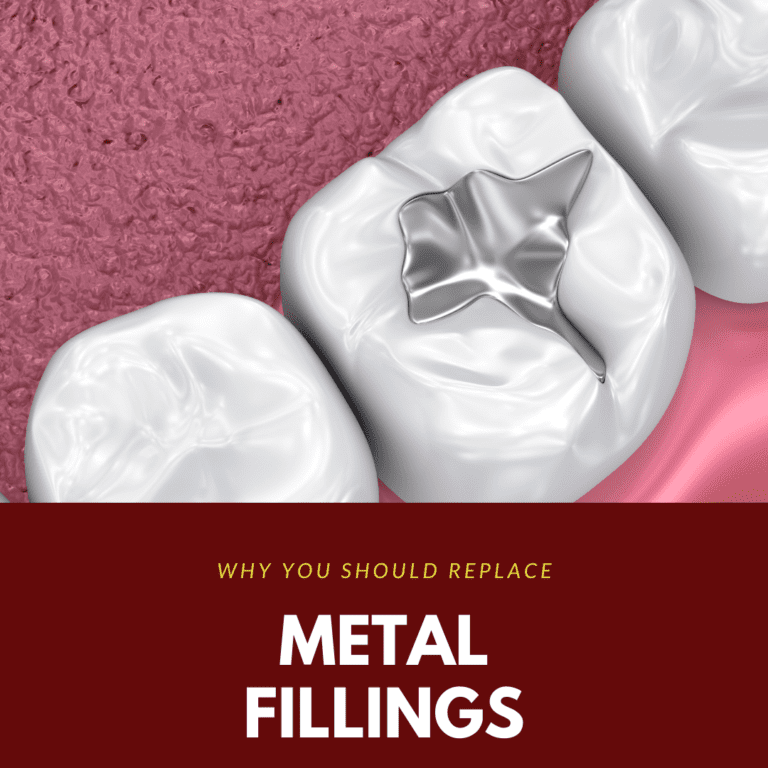 Why You Should Replace Metal Fillings2