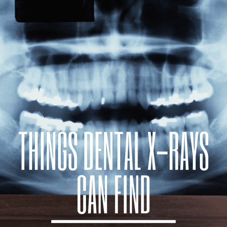 Things Dental X-Rays Can Find