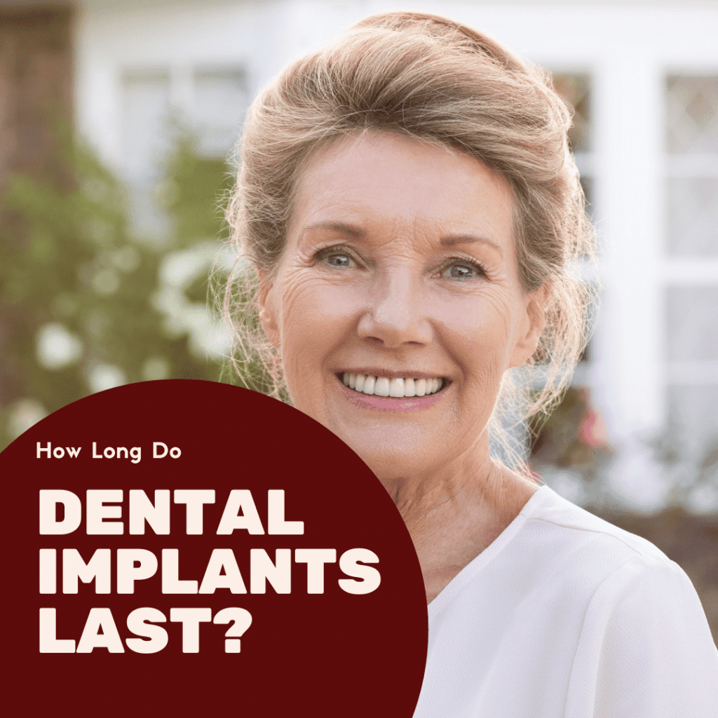 how long do dental implants last