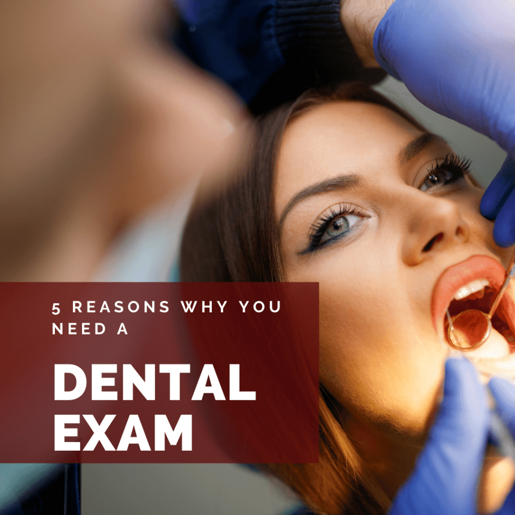 5 Reasons Why You Need a dental exams