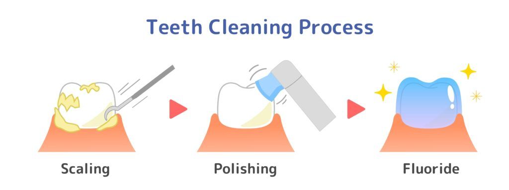 teeth cleaning process