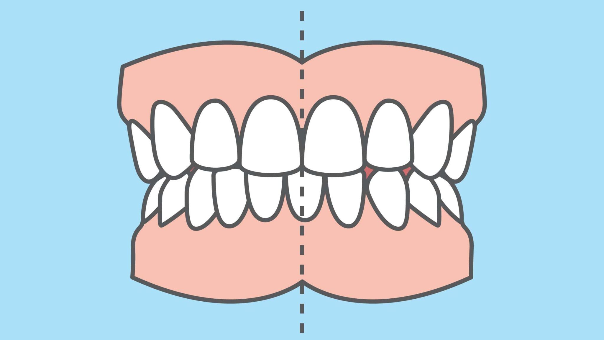 dental midlline