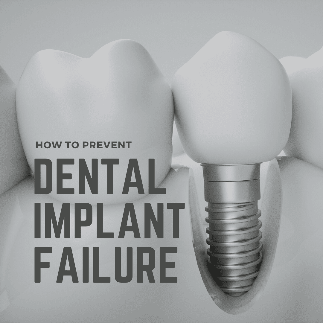 how-to-prevent-implant-failure-west-palm-beach-dentist