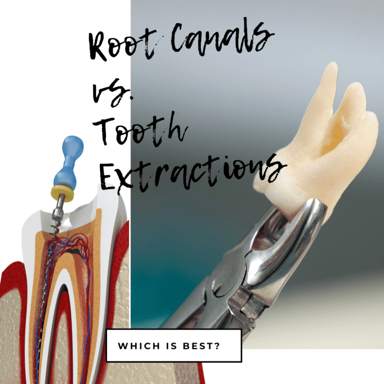 Root Canals vs. Tooth Extractions