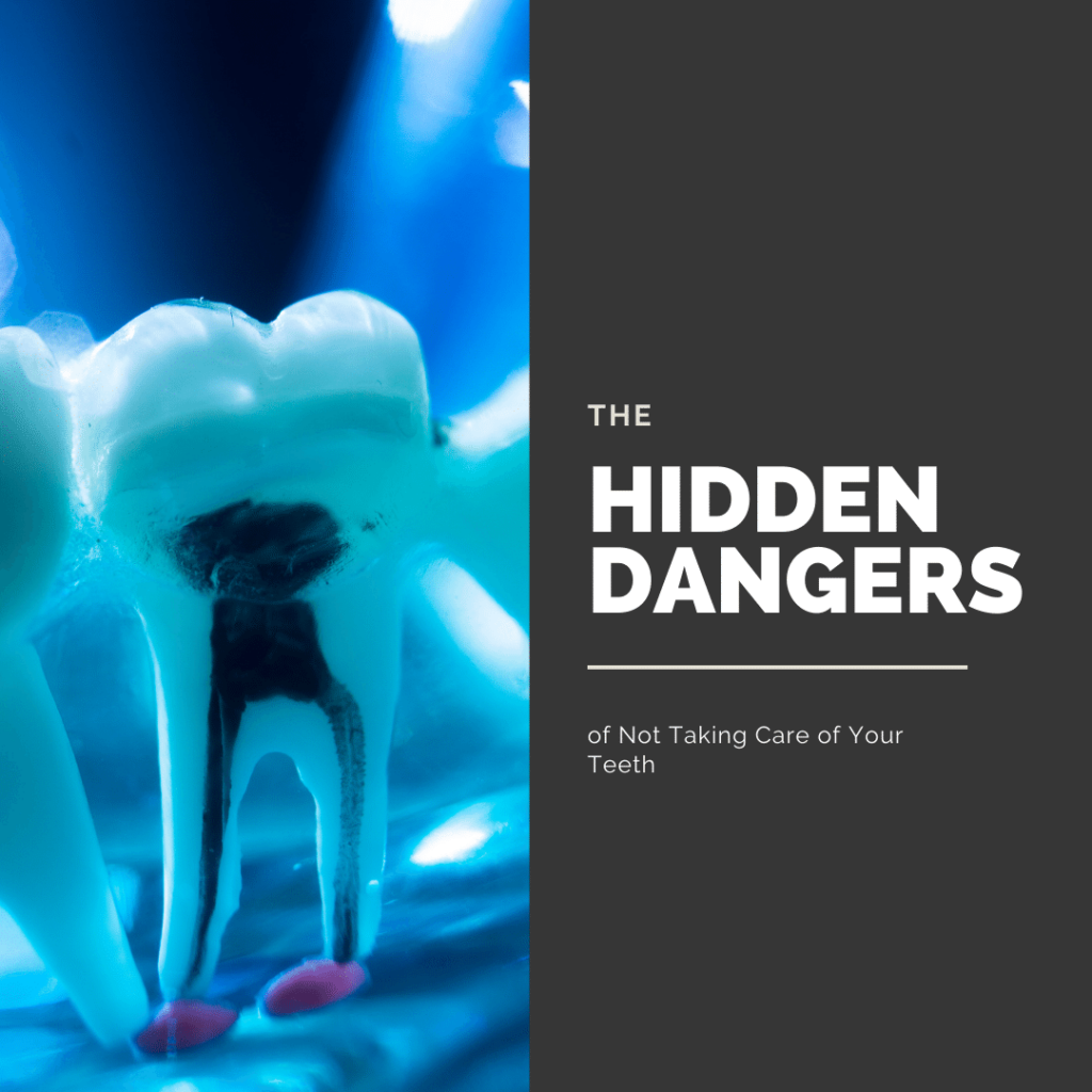 The Hidden Dangers of Not Taking Care of Your Teeth