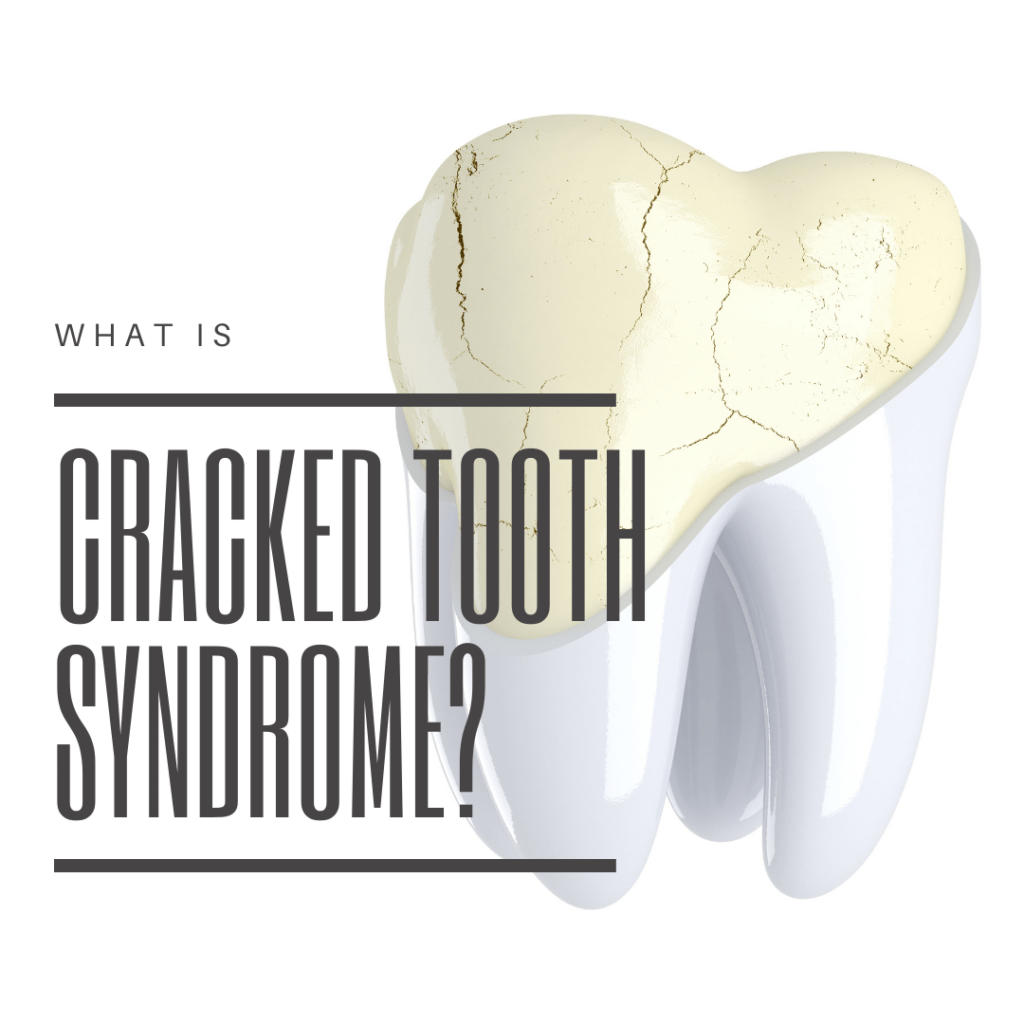 What is cracked tooth syndrome