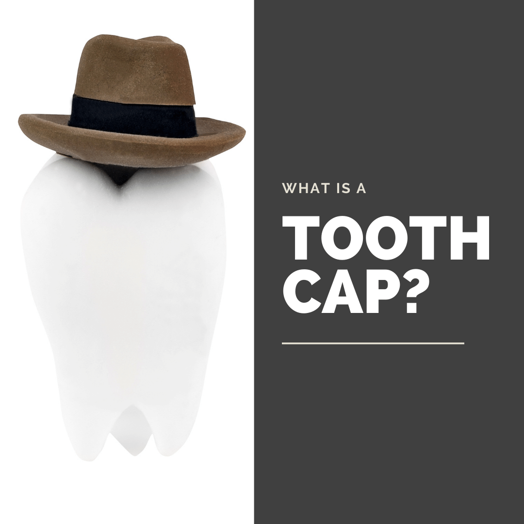 What is a Tooth Cap? West Palm Beach Dentist