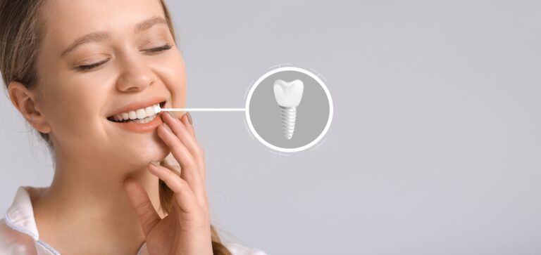 5 Reasons to Gift Yourself Dental Implants for the New Year