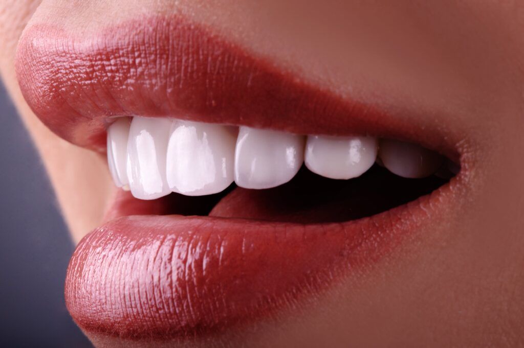 woman smile with white teeth
