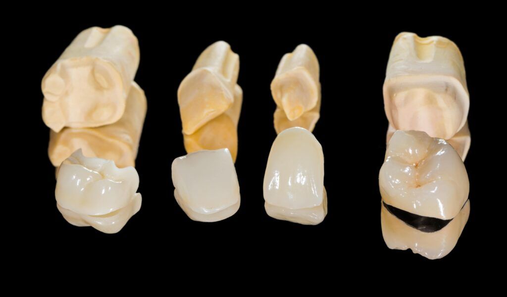 various dental restorations on a black background