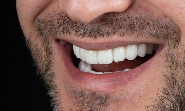 closeup of man with perfect smile